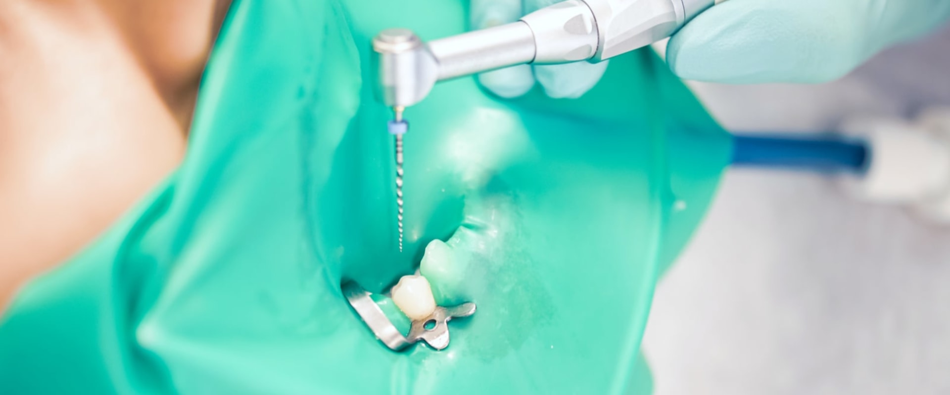 The Latest Advancements in Endodontic Technology