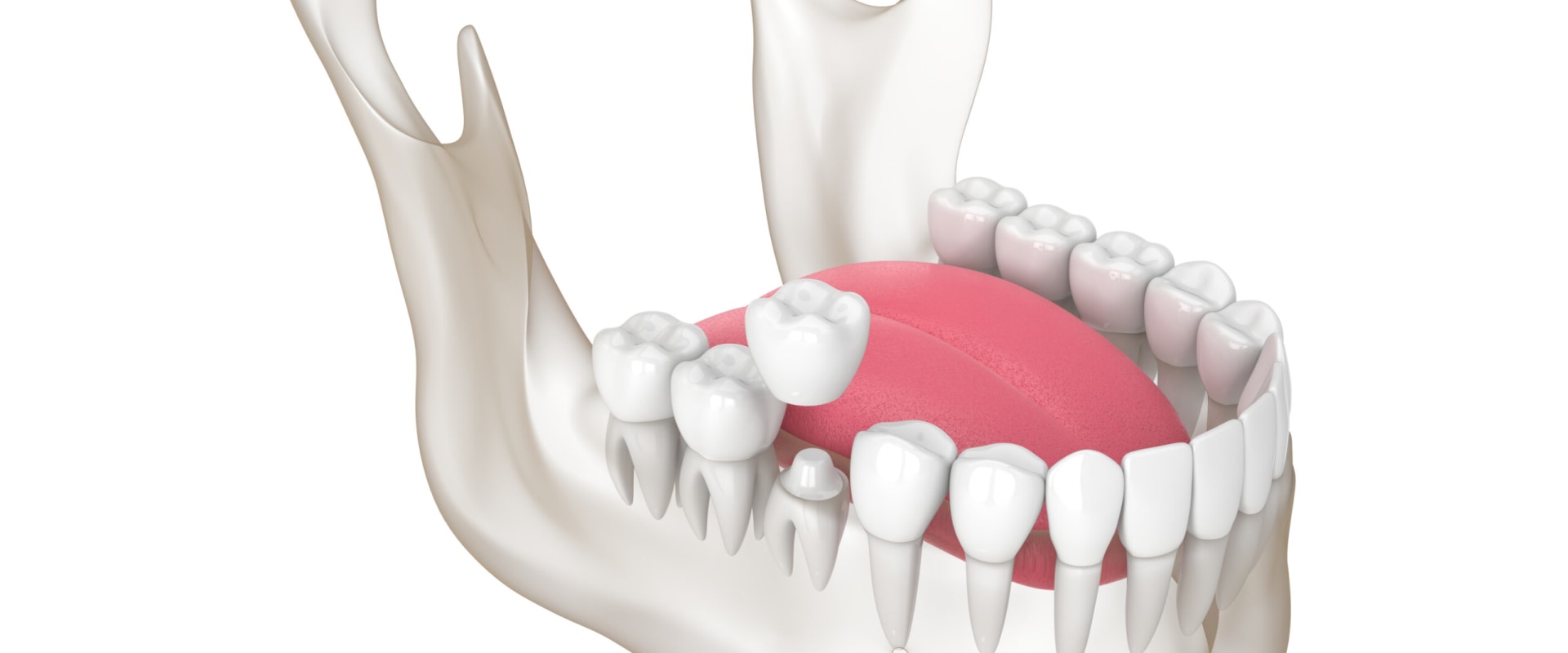 Maintaining Proper Function of the Teeth and Jaw