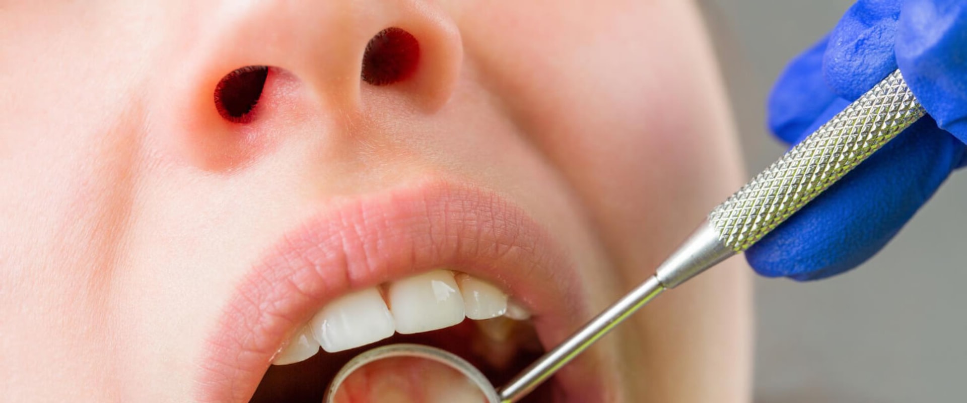 10 Important Questions to Ask During Your Endodontist Consultation