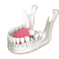 Maintaining Proper Function of the Teeth and Jaw