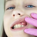 Understanding Severe Tooth Pain and Swelling: What You Need to Know