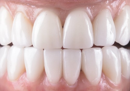 The Long-Term Benefits of Addressing Underlying Dental Issues